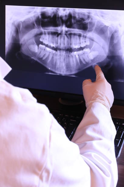 Best Emergency Treatment for Toothache in Mccleary, WA